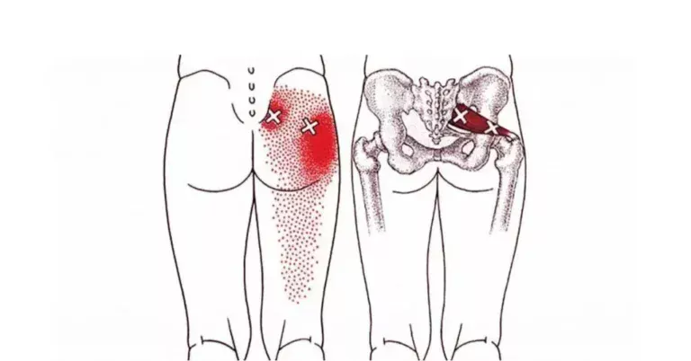 imgi_2_Piriformis-Stretches-Get-Rid-Of-Sciatica-Hip-And-Lower-Back-Pain-1024x536-1.jpg